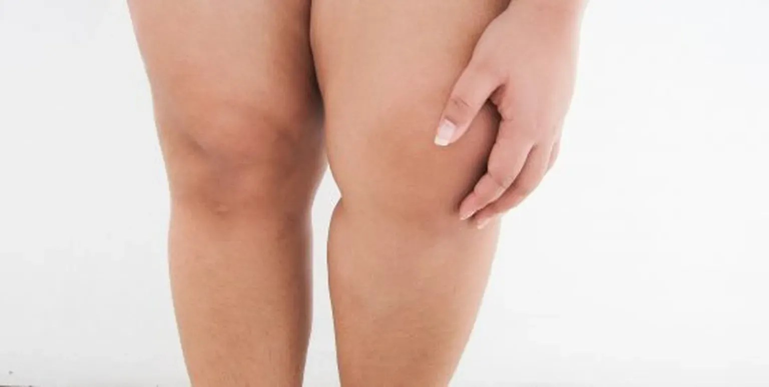 The Cycle of Knee Pain and Weight Gain Reflex Knee Specialists