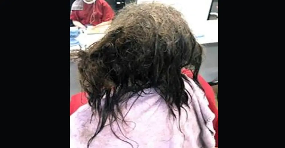 Hairstylist Left Heartbroken Seeing Depressed Girl With Matted Hair