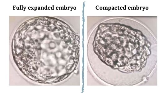 Complete Guide to Embryo Grading and Success Rates Remembryo