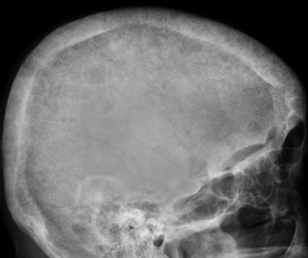 Parathyroid Imaging in Patients with Kidney Disease Renal Fellow Network