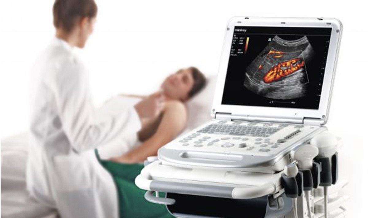 Rent Ultrasound Machines (Short Term & Long Term Rental Options)