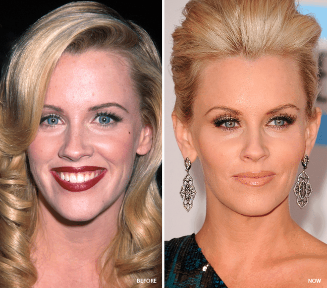 Celebrity Skin Care