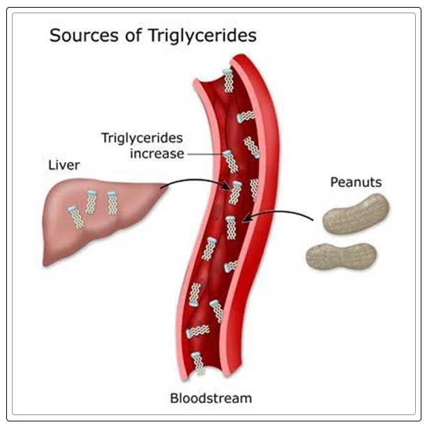 High Triglycerides Risks, Causes, and Treatment REPC