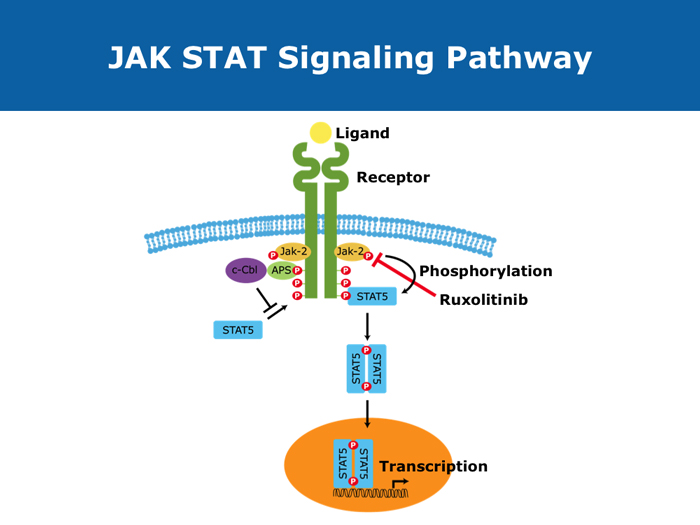 JAK Inhibitors in Myelofibrosis Research To Practice