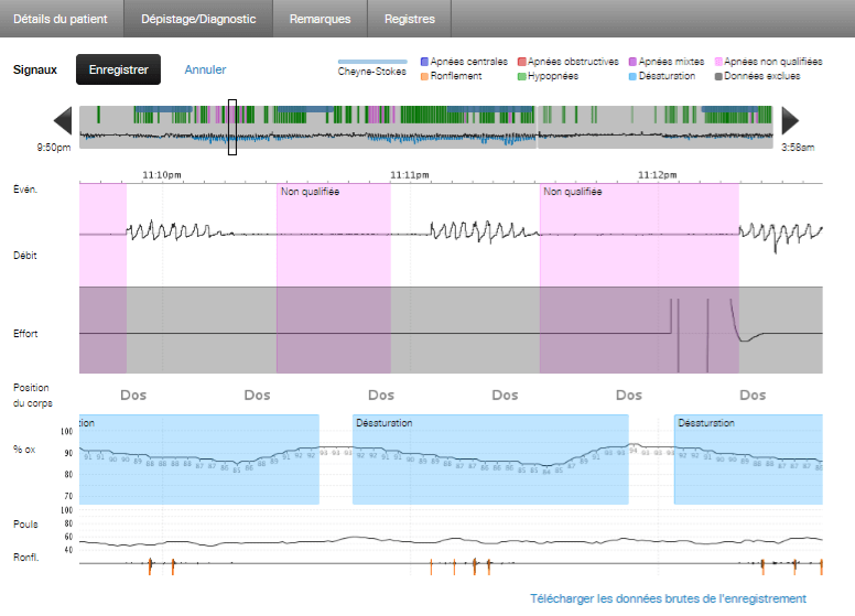apnealinkair™diagnosticrapportresmed