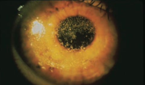 When To Send Out Sjogren S