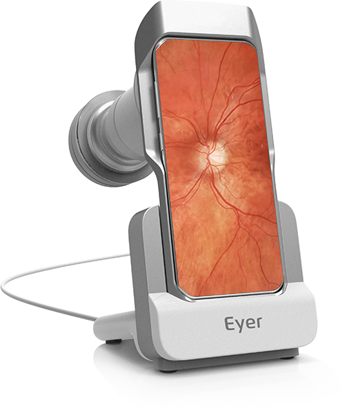 What You Need to Know About Fundus Photography?