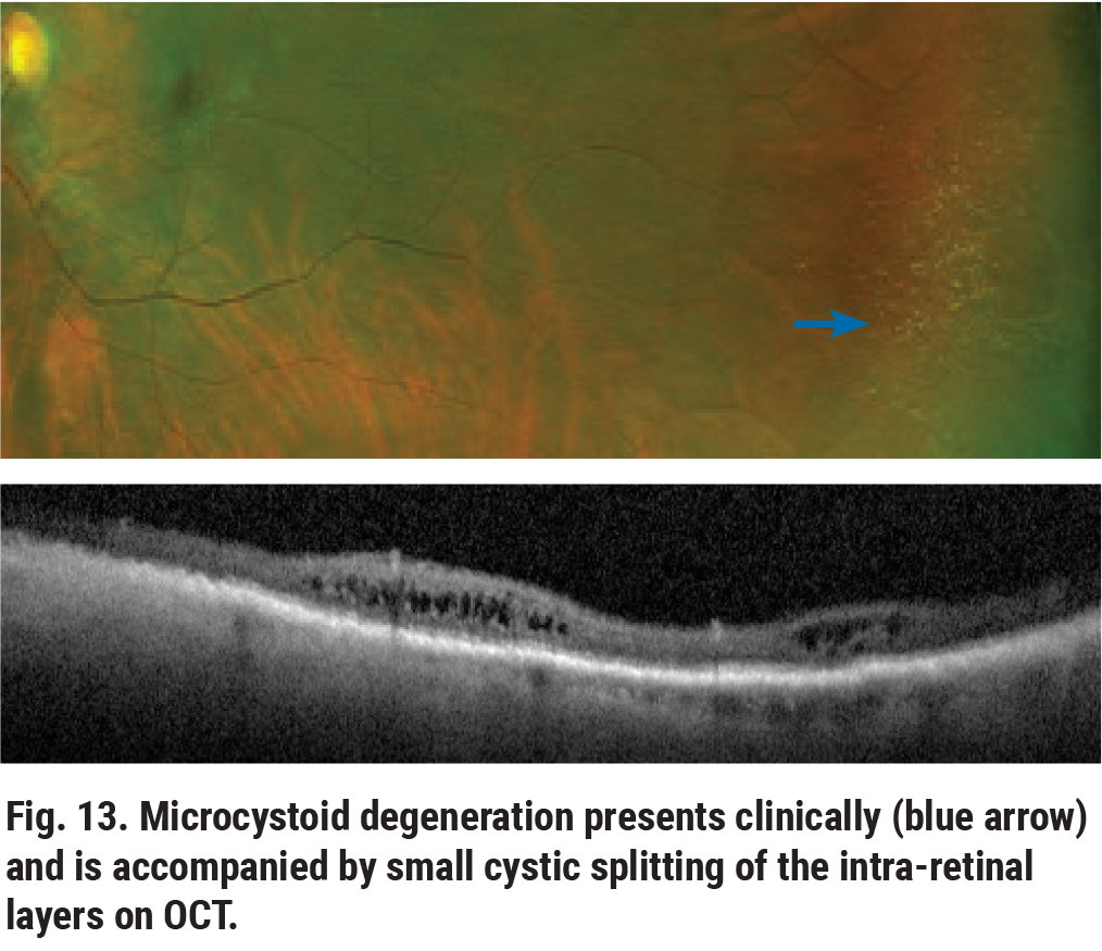 Navigating the Retinal Periphery