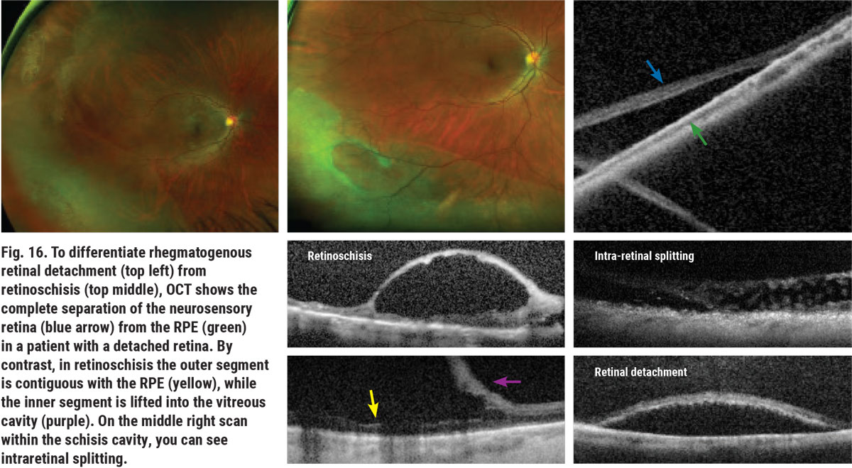 Navigating the Retinal Periphery
