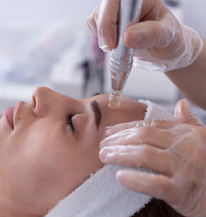 Microneedling In Detroit & Farmington Hills, MI Revive Med Spa