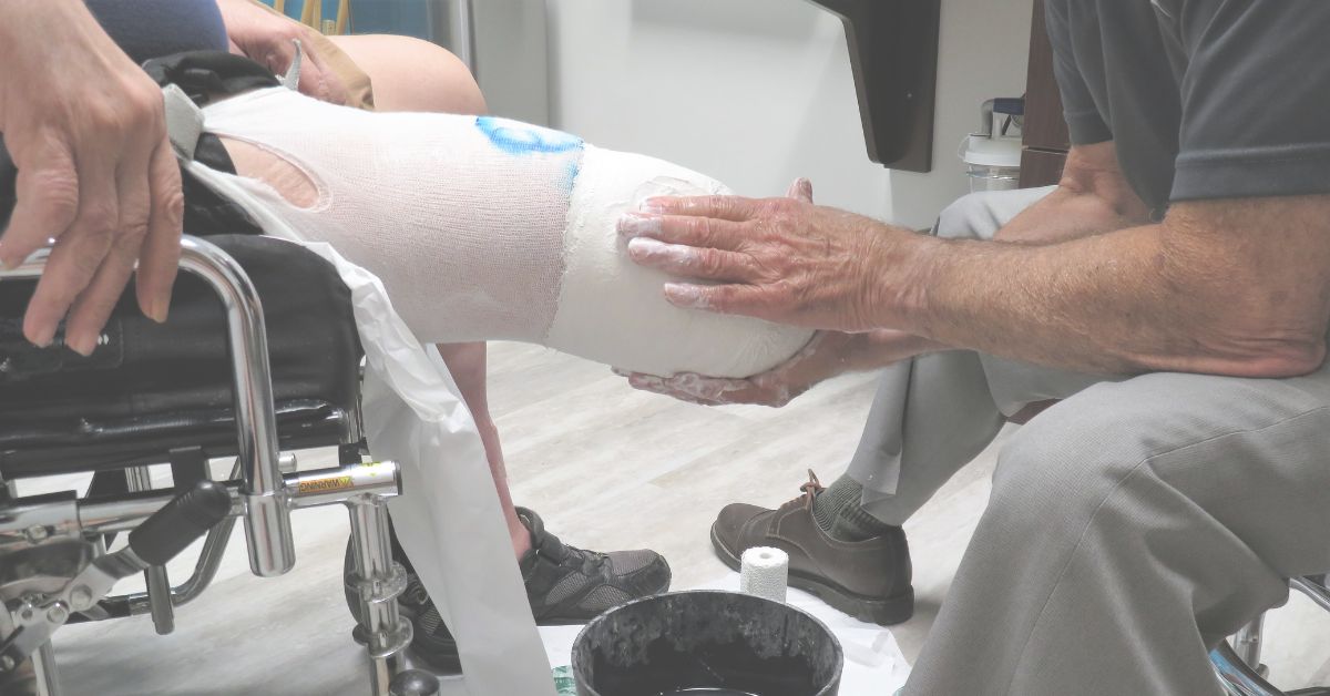 Resources and Support for Amputees and Their Families