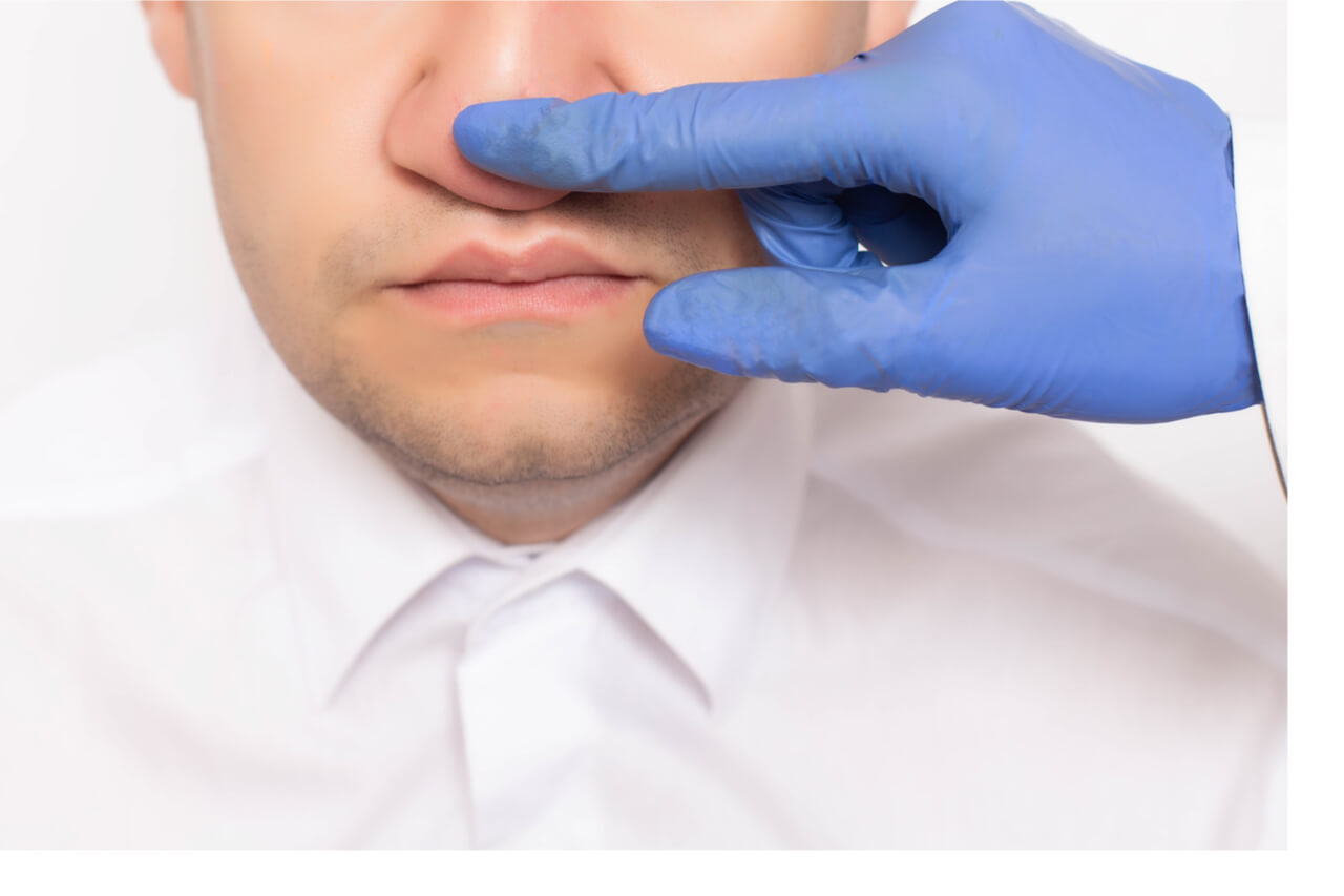Do You Think You Have a Deviated Septum? Rhinoplasty Sydney Cost