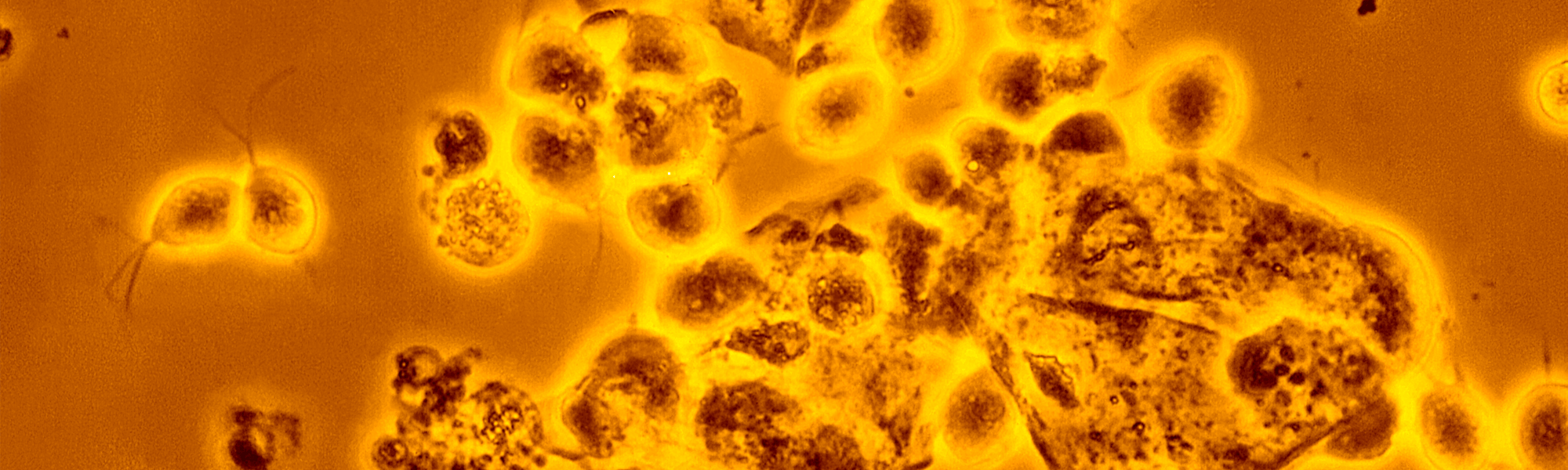 Trichomoniasis Right to Know