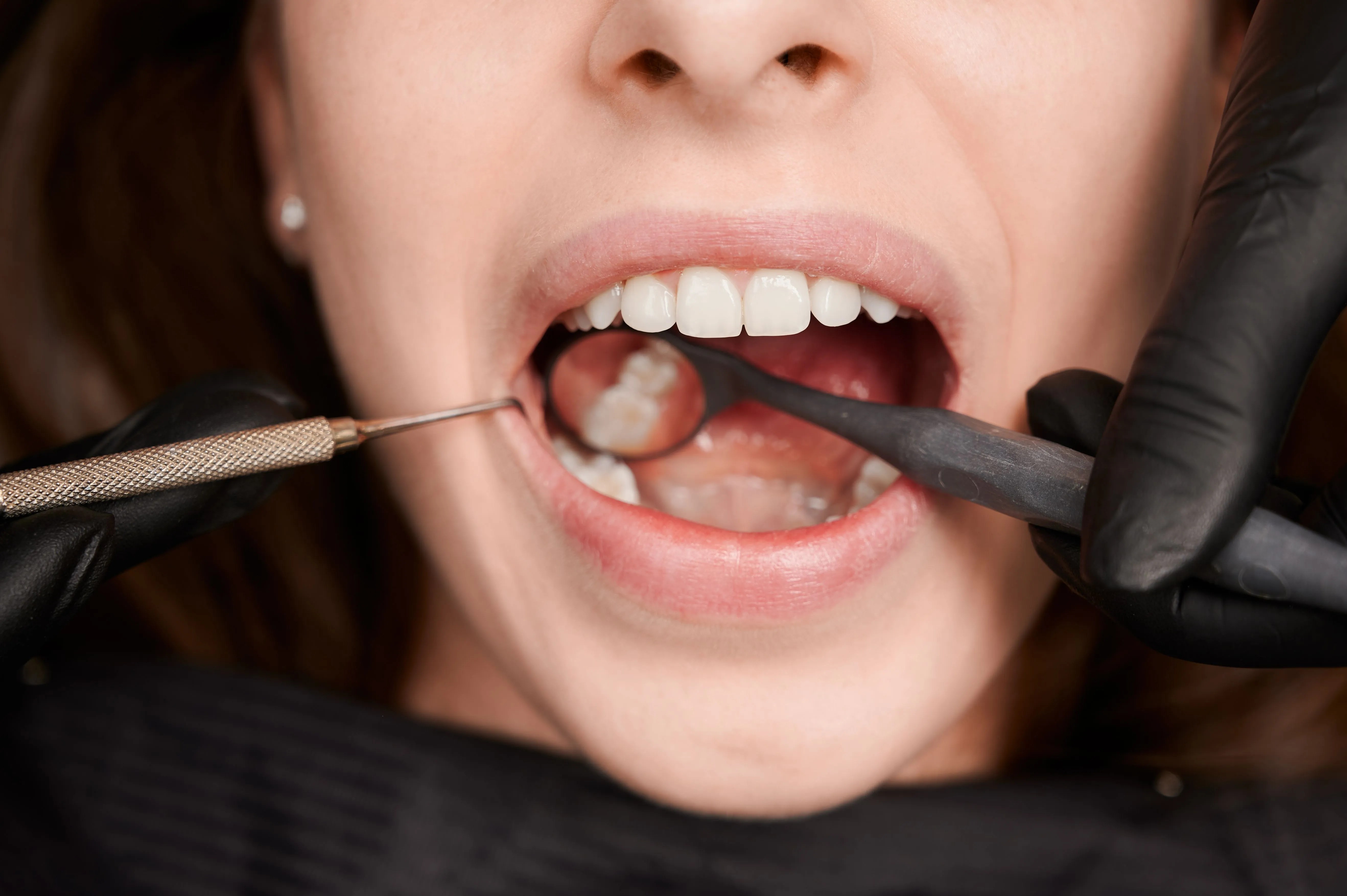How Long Does a Teeth Cleaning Take?