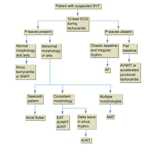What Is Medical Term Svt at Annie Foster blog