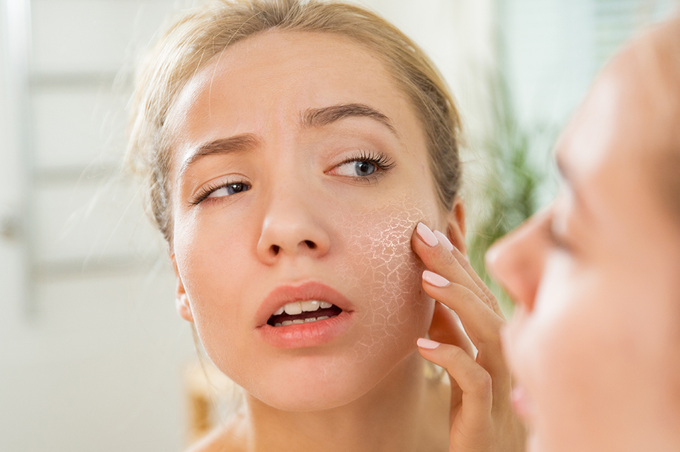 How to Prep for Seasonal Dry Skin Dr. Burke Robinson