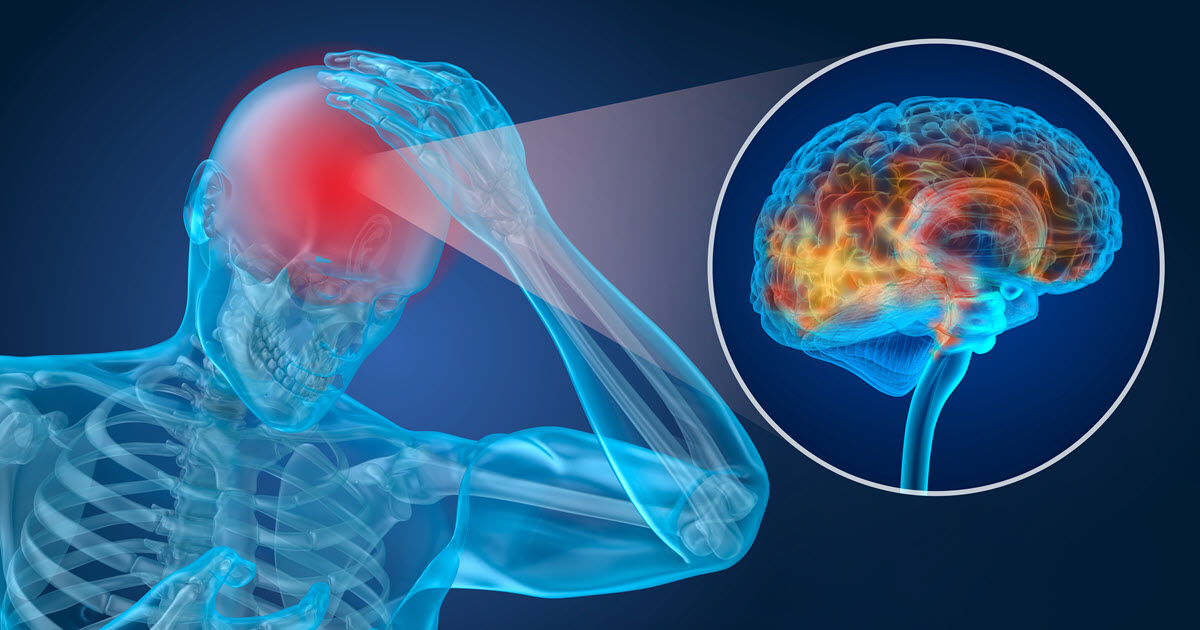 What Is PostConcussion Syndrome? Traumatic Brain Injury