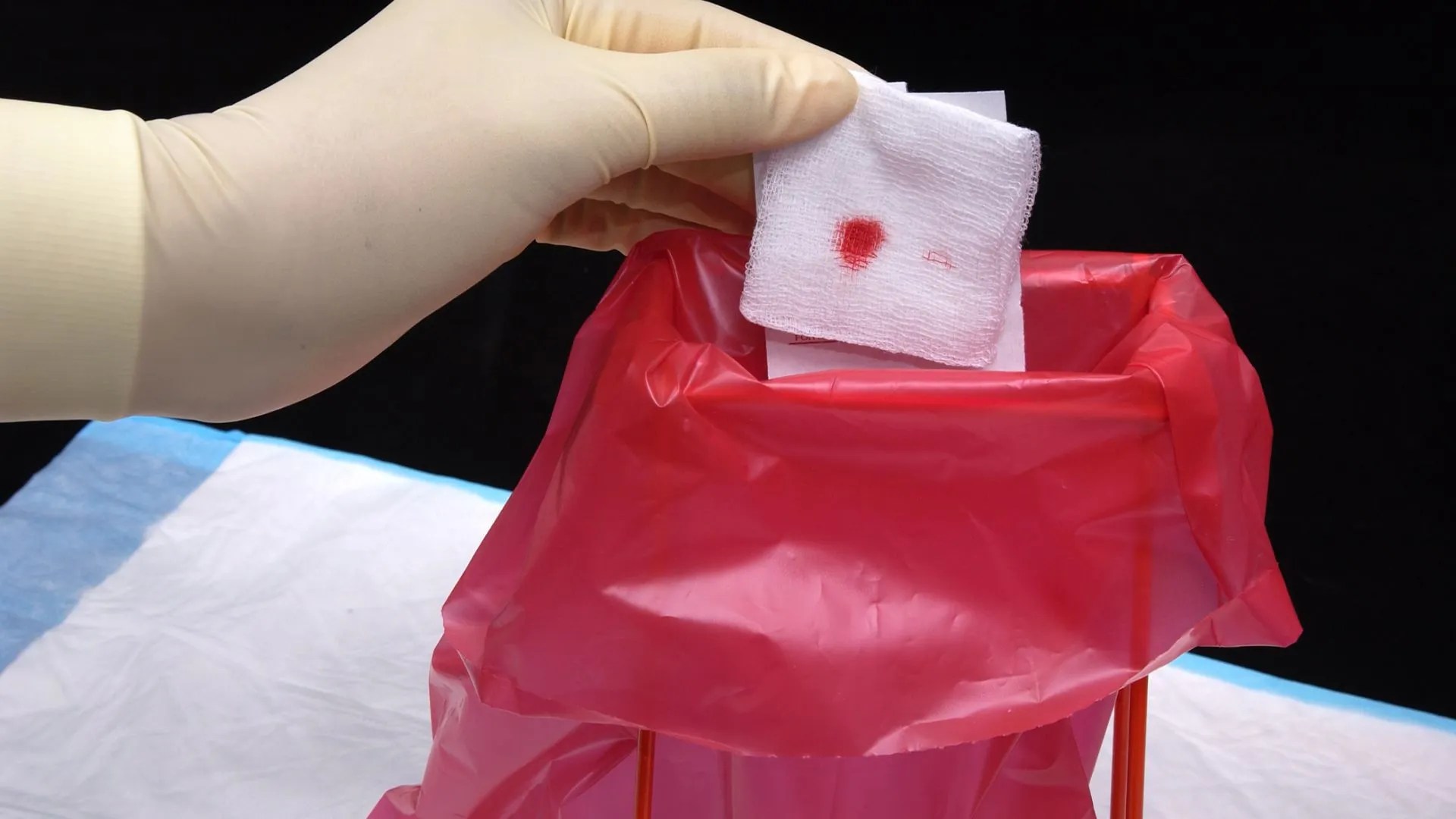 How Long To Keep Gauze in After Tooth Extraction Roots Dental