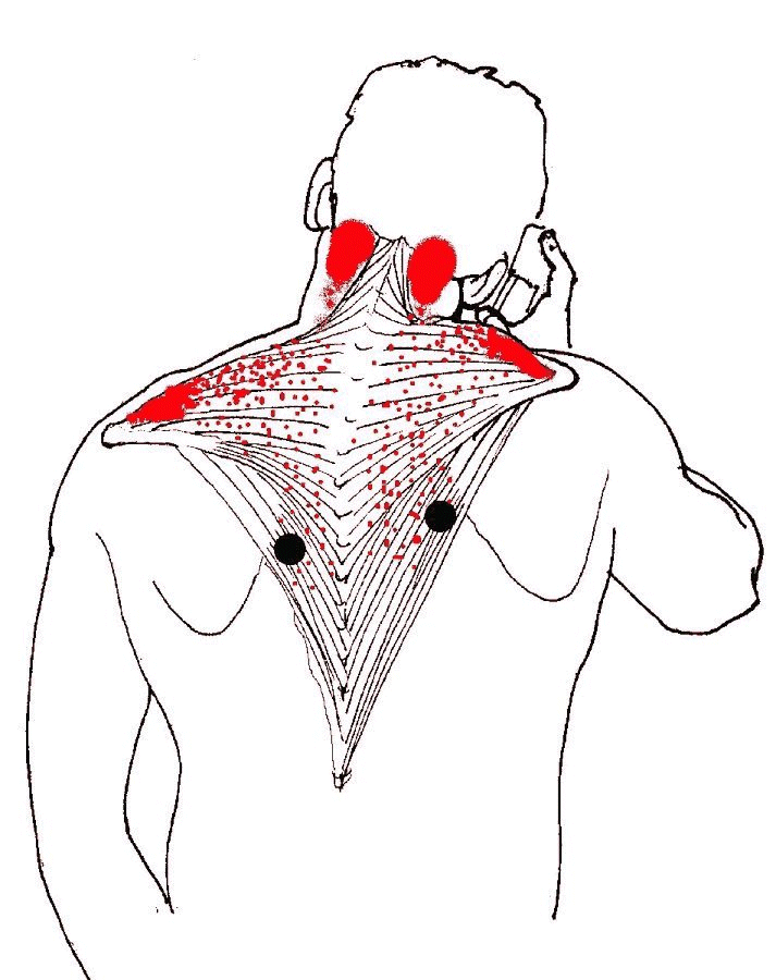 ROUND EARTH PUBLISHING INTRODUCTION TO SHOULDER PAIN