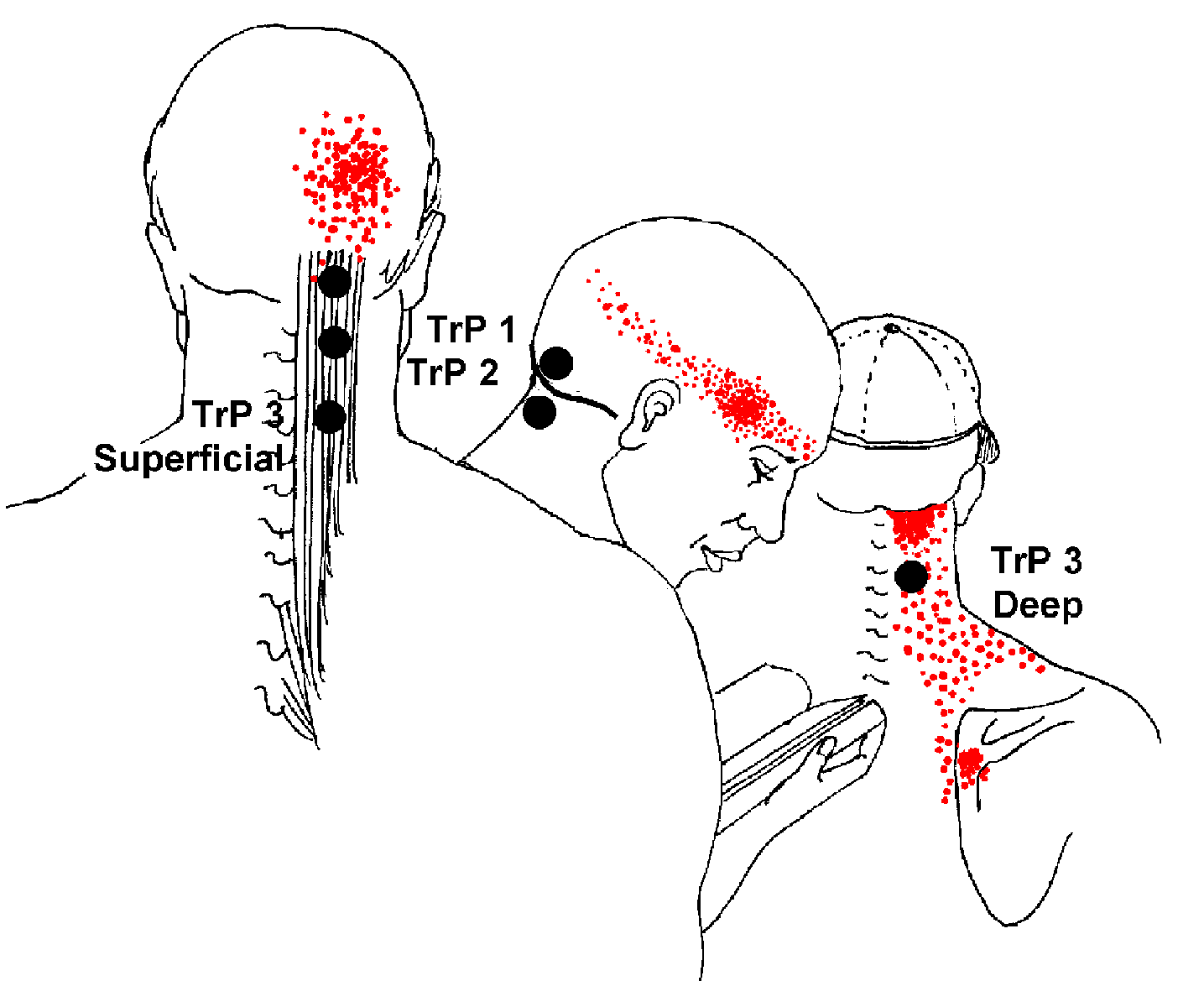 ROUND EARTH PUBLISHING INTRODUCTION TO HEAD PAIN