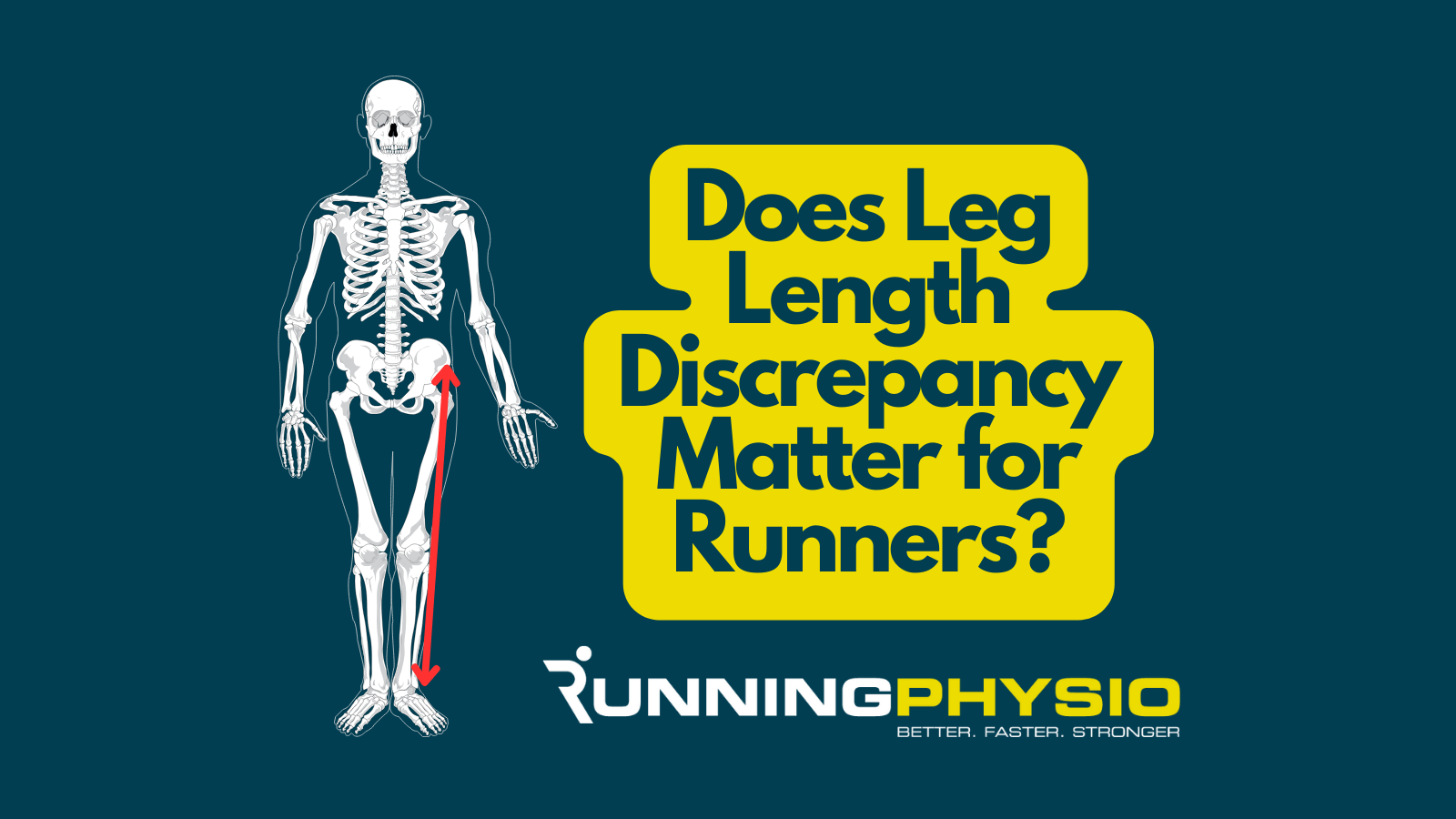 Does Leg Length Discrepancy Matter for Runners? RunningPhysio