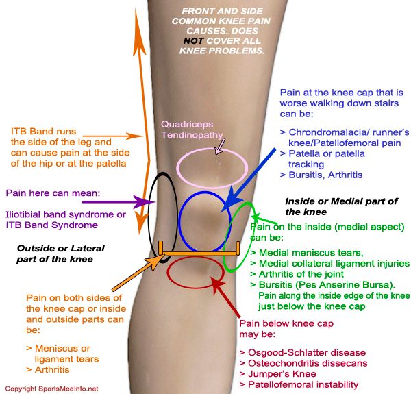 Knee Pain After Running 7 Common Causes And Treatments