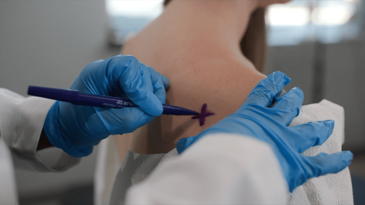 Trigger Point Injections Targeted Pain Relief RxWellness