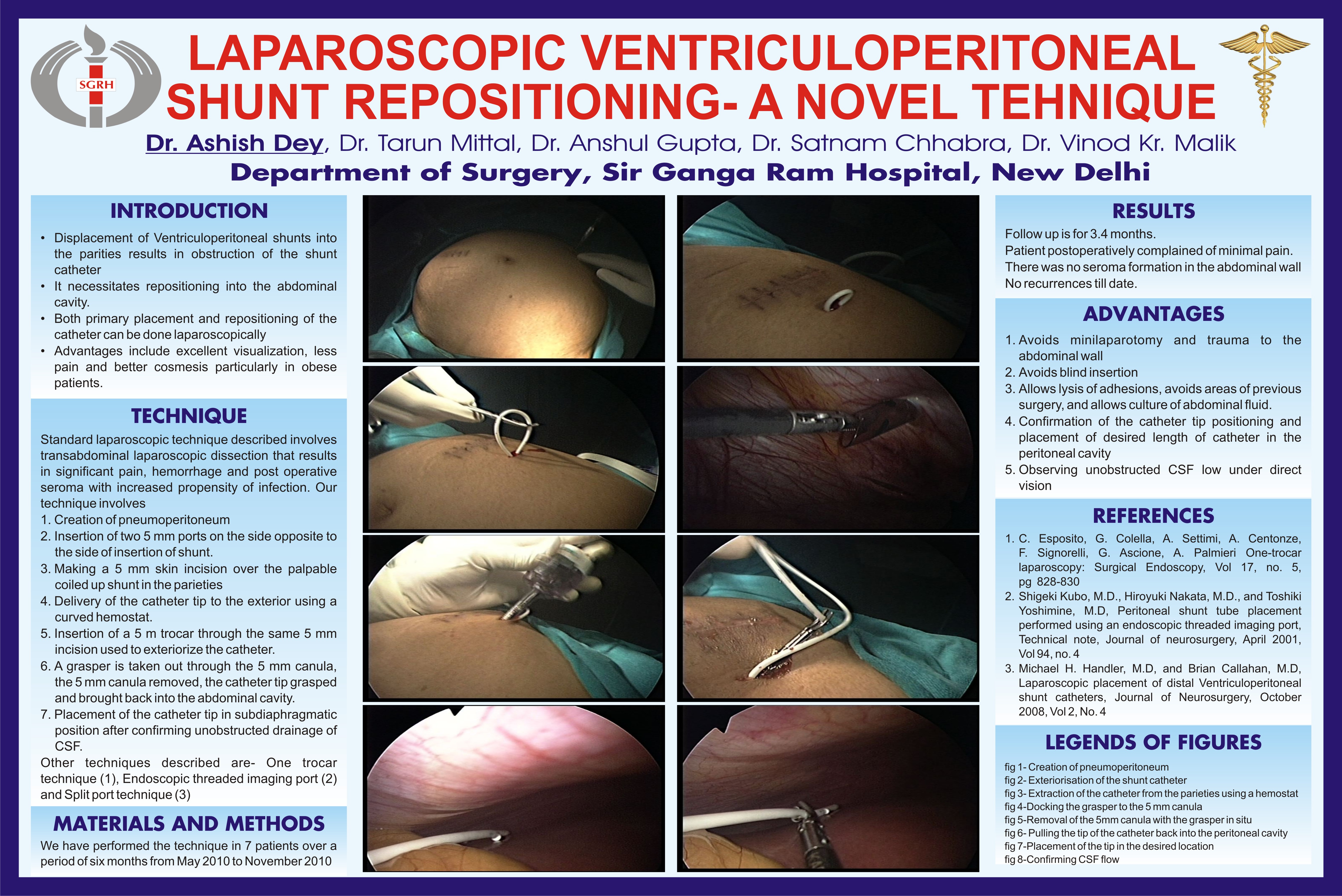 Laparoscopic Ventriculoperitoneal Shunt Repositioning a Novel Technique SAGES Abstract Archives