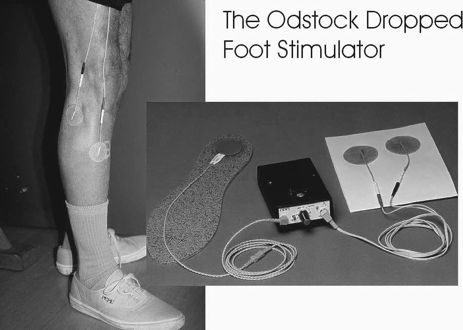 The use of electrical stimulation for correction of dropped foot in