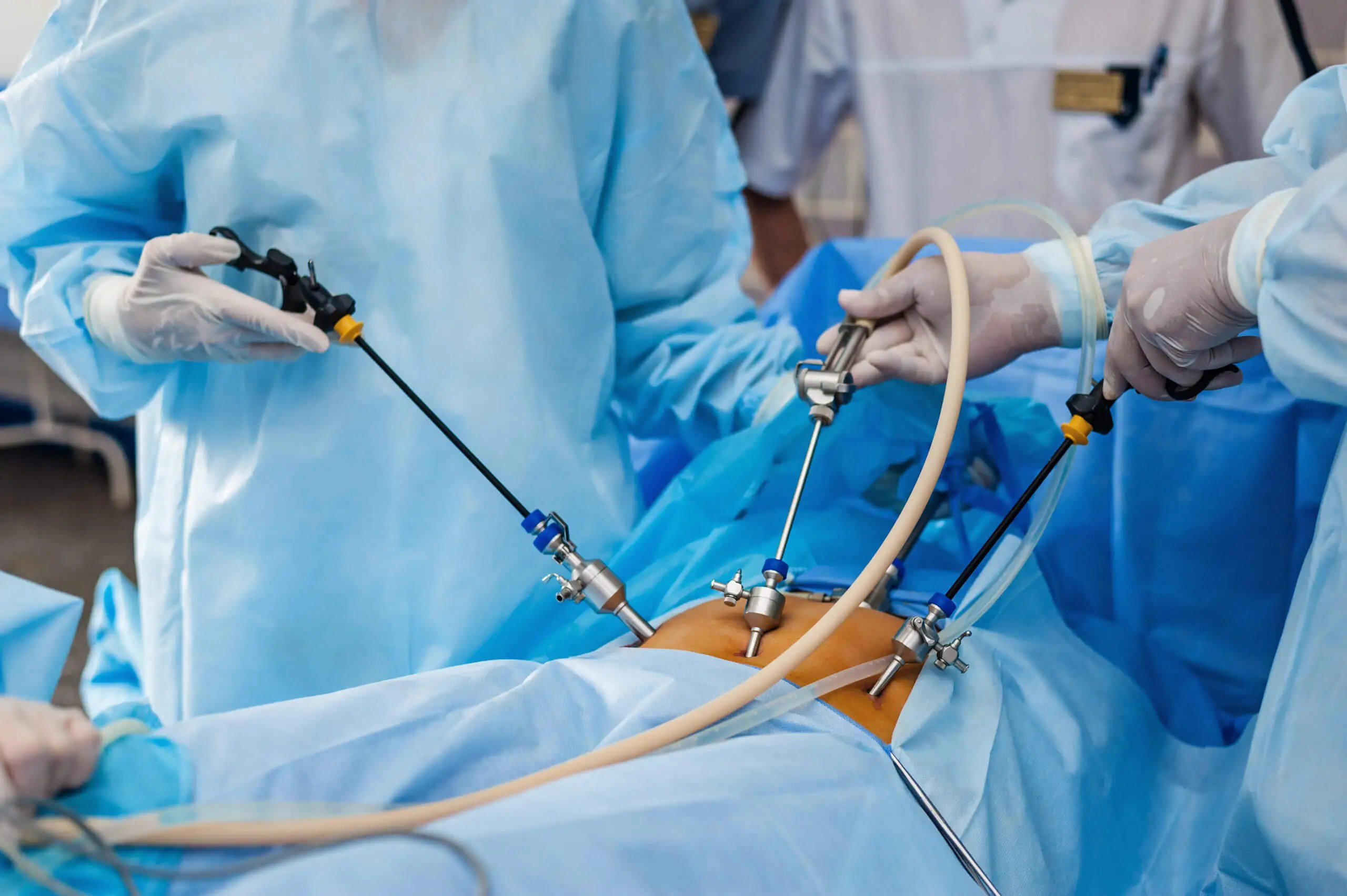 Unmasking the Hidden Benefits and Surprising Facts about Laparoscopic