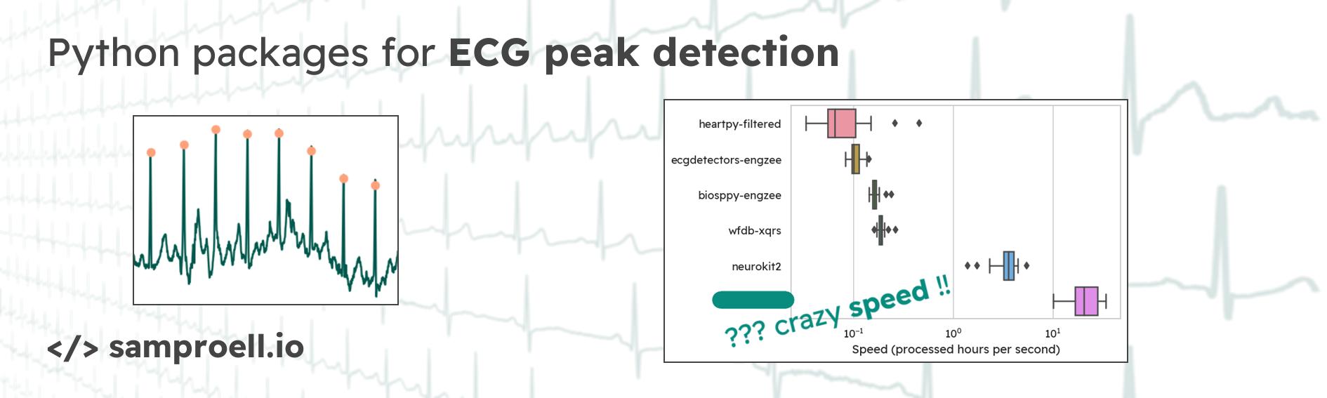 ECG R peak detection in Python a comparison of libraries Samuel