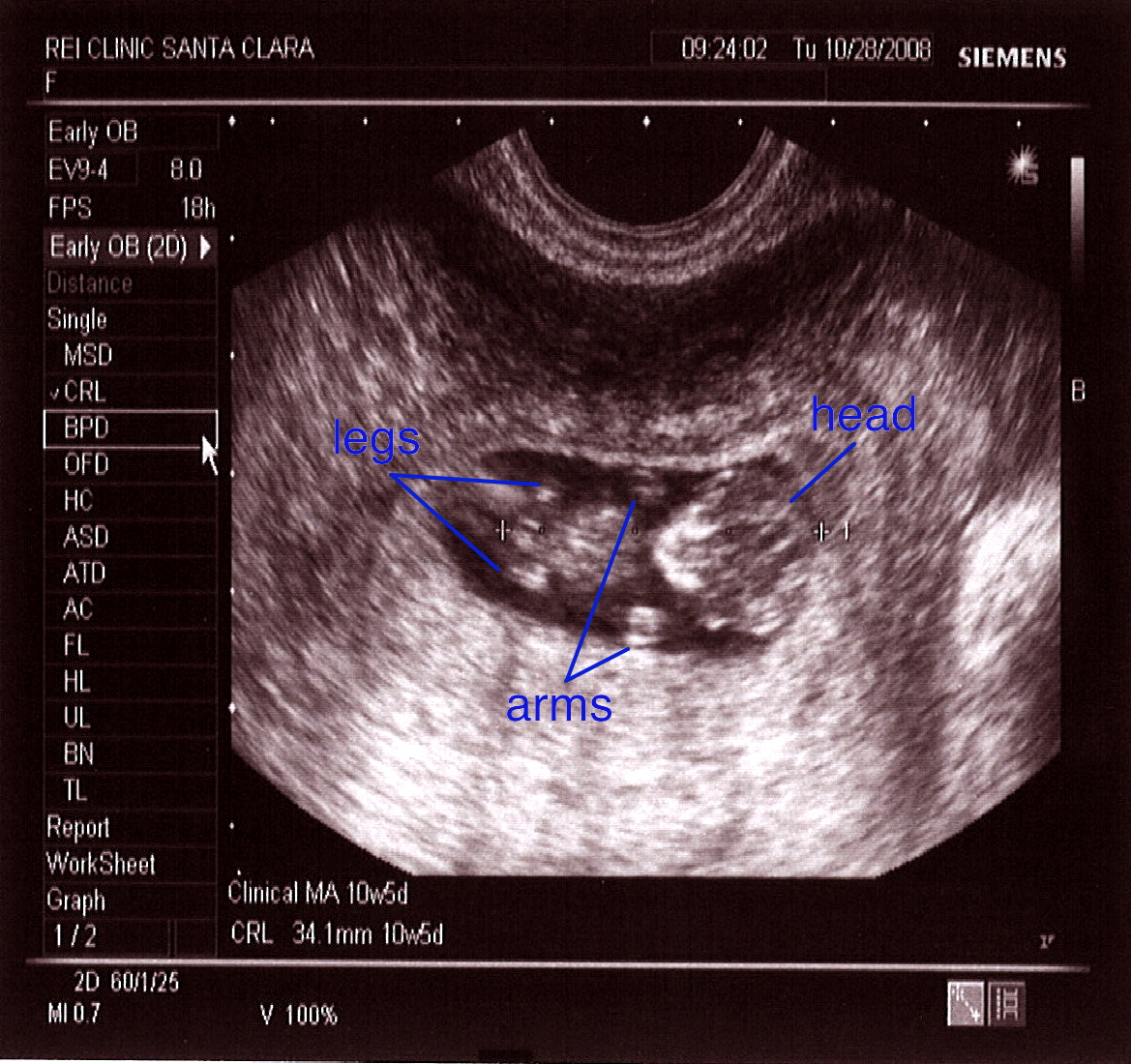 Sprout Too Much Information