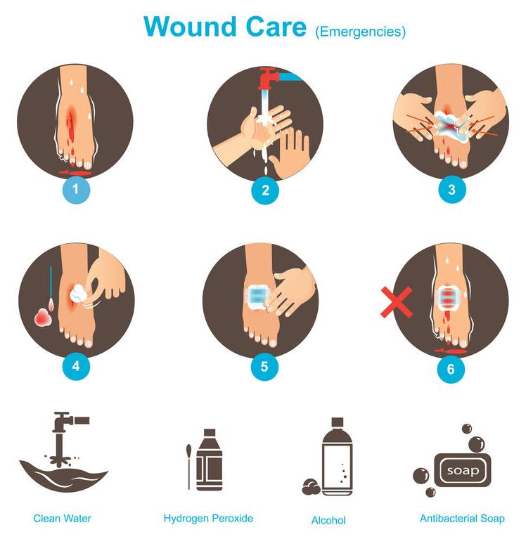 Wound Care Steps
