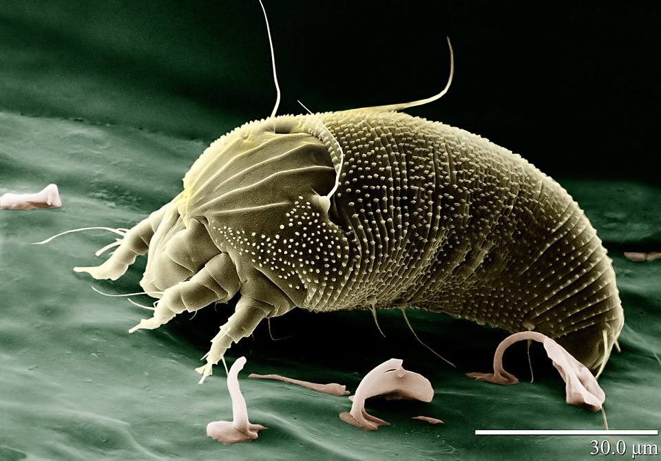 Demodex Mites