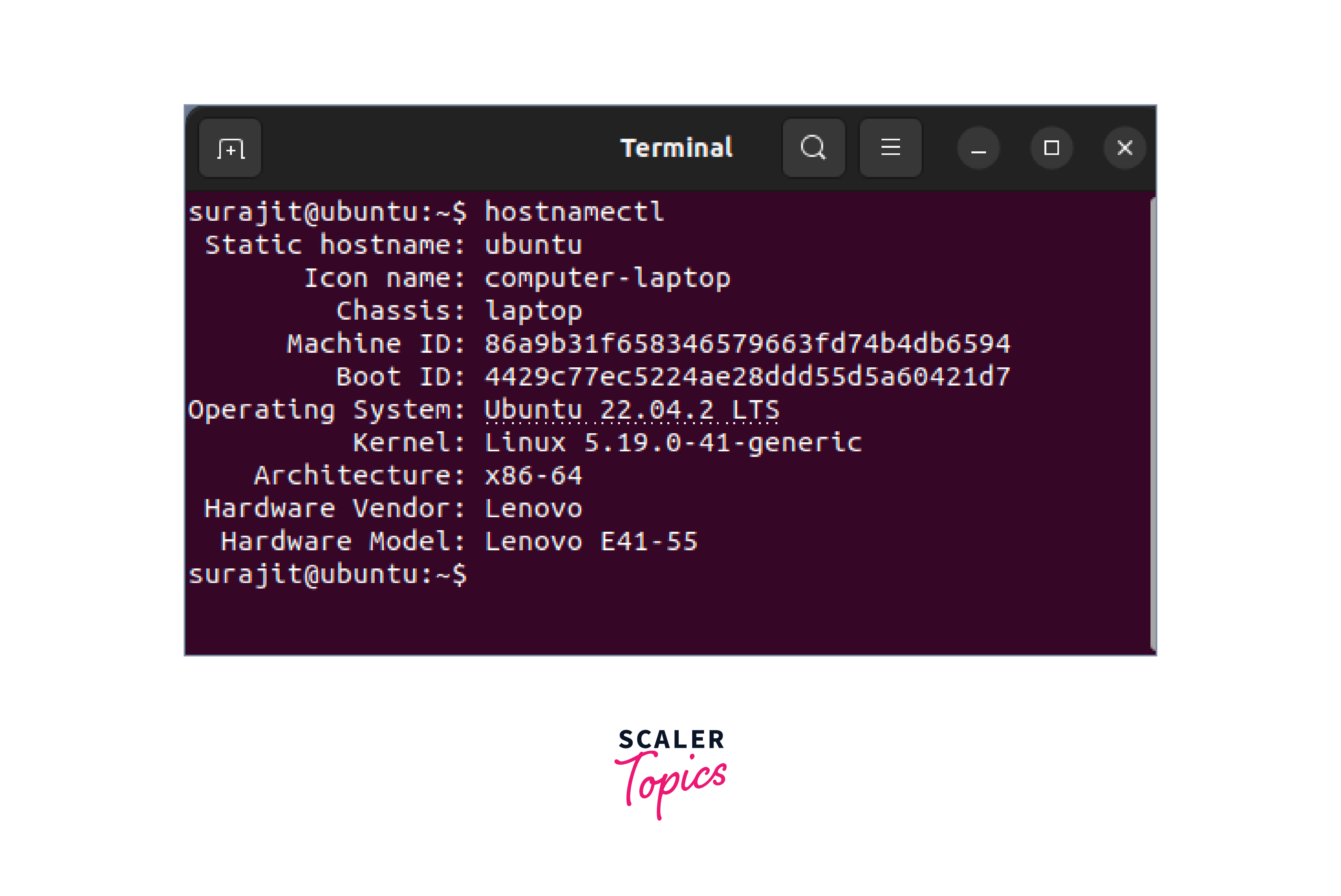 How To Configure DNS Server In Linux? Scaler Topics