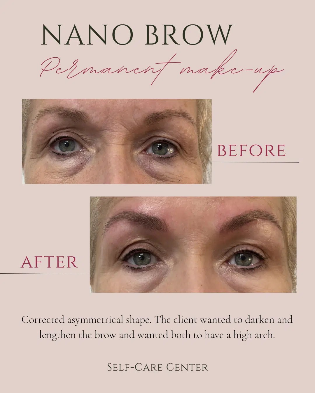 Customized Facial Services in Venice, FL Self Care Center