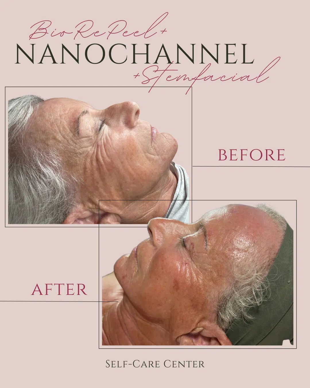 Customized Facial Services in Venice, FL Self Care Center