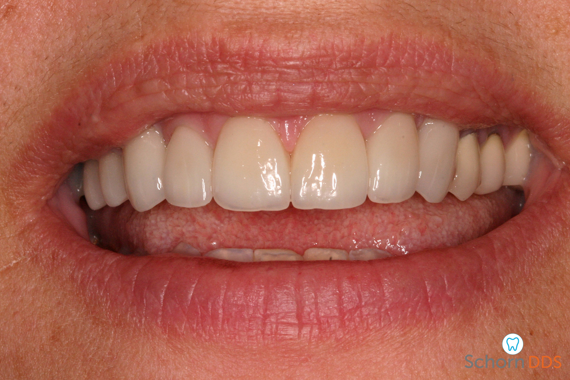 Schorn DDS Dallas, TX Services