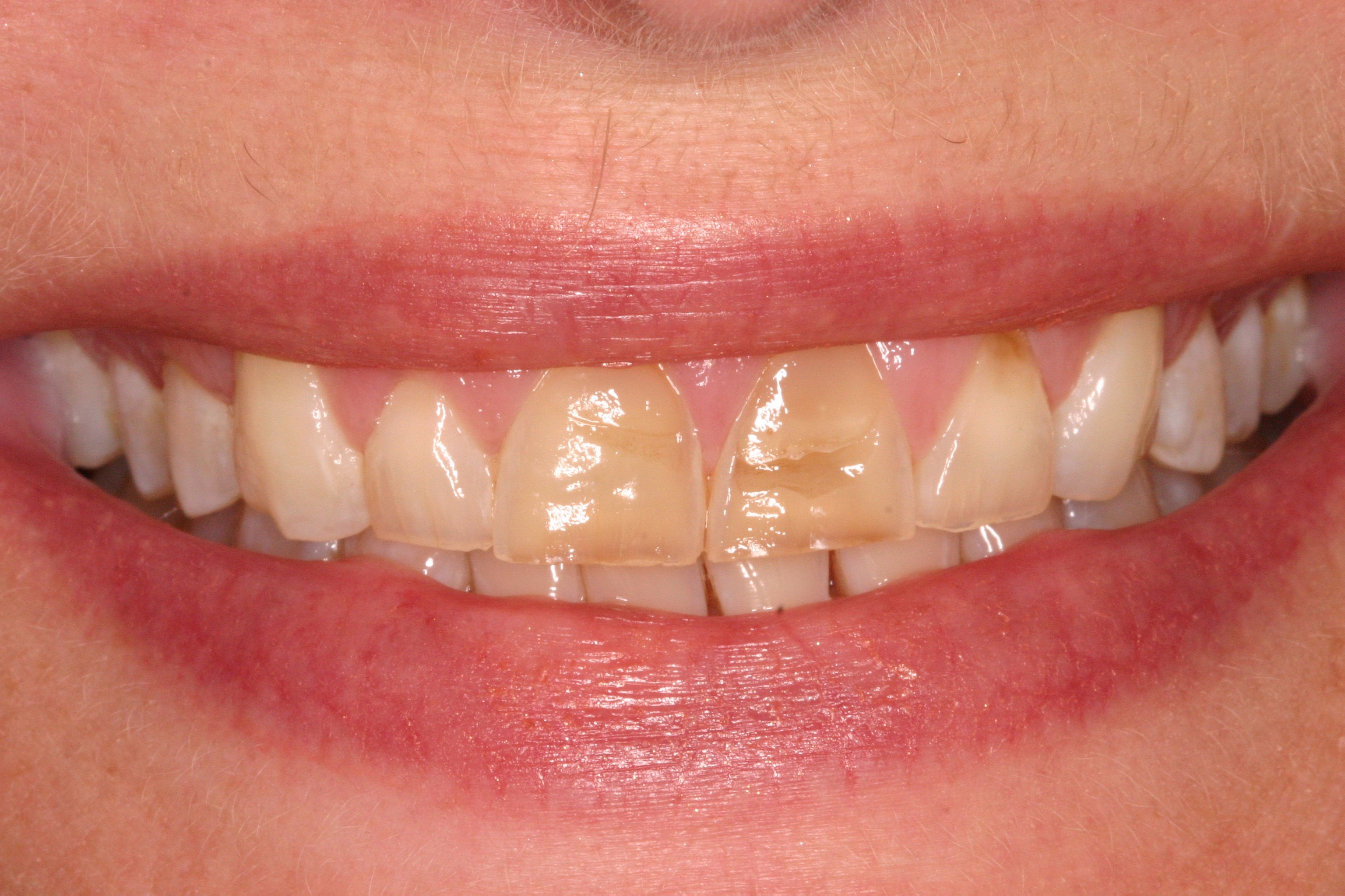 Schorn DDS Dallas, TX Services