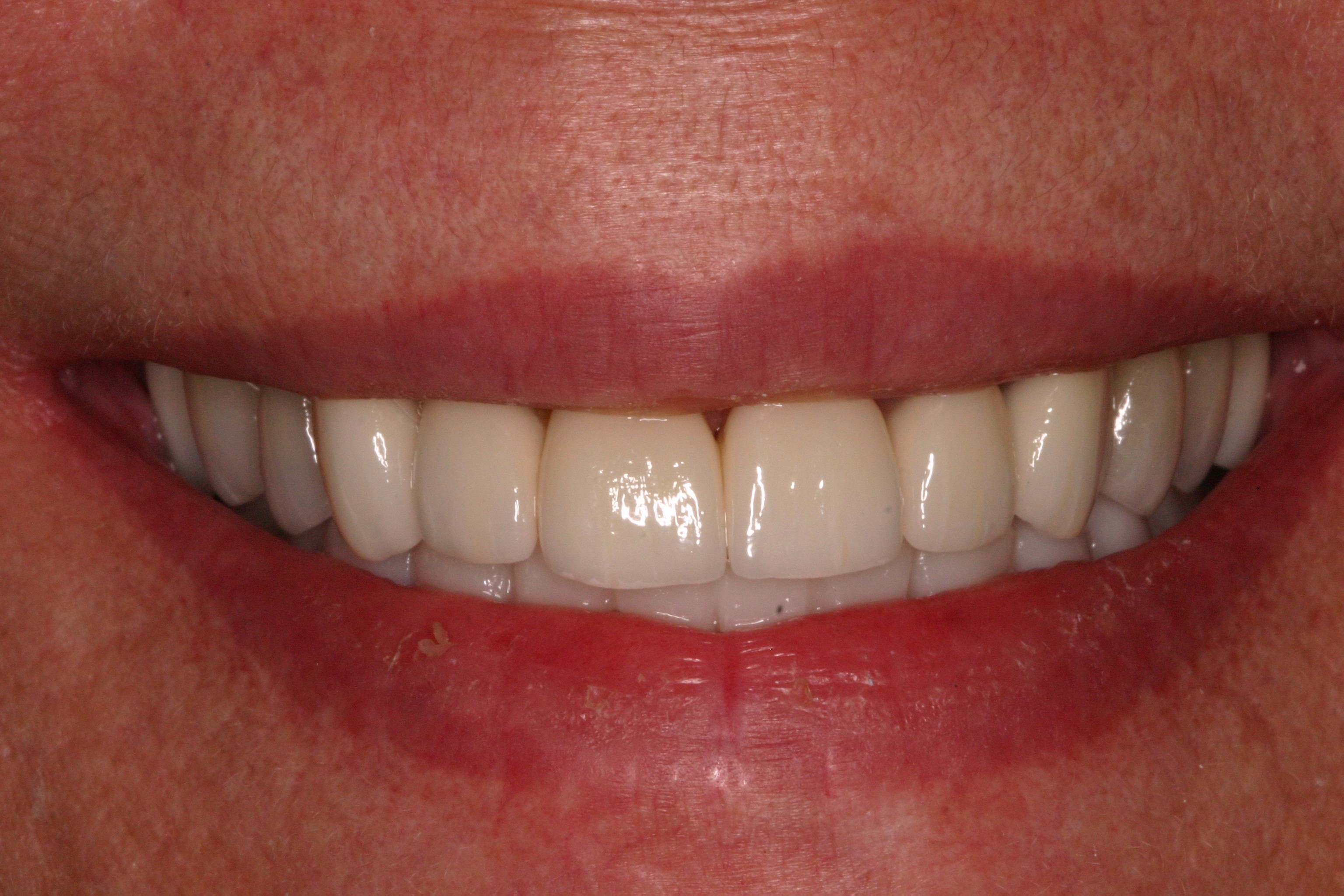 Schorn DDS Dallas, TX Services