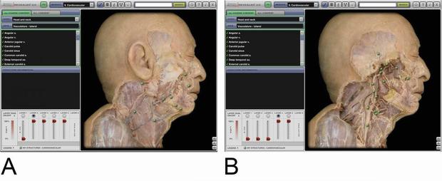 For Learning Anatomy, Cadavers Still Work Best Science 2.0