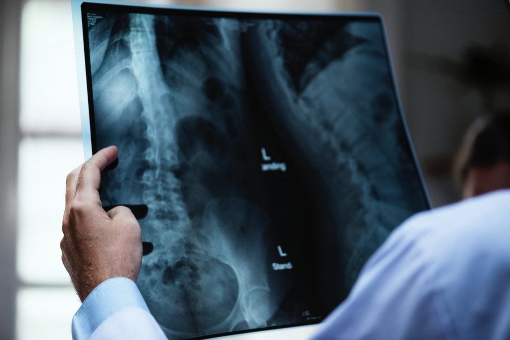 X Ray Definition, Properties, History And Applications