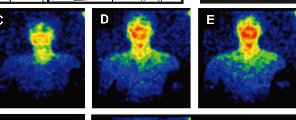 You Can't See It, But Humans Actually Glow With Our Own Form of