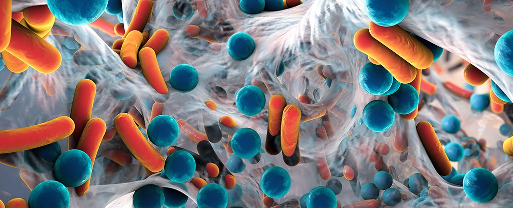 Even More Evidence Has Linked Parkinson's Disease to Our