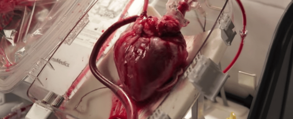New 'HeartinaBox' Device Revives Dead Hearts For Transplant