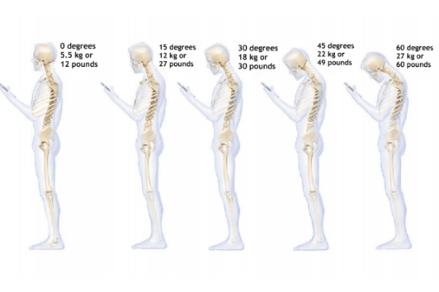 New study reveals what checking your phone is doing to your neck
