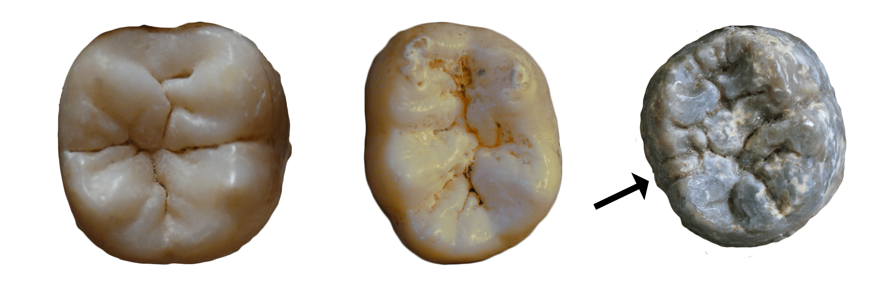 The Wisdom of Teeth Science Friday