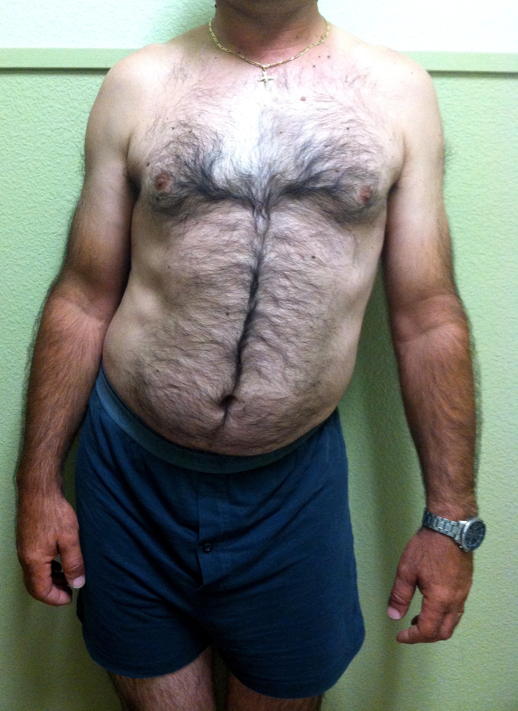 Science of Massage Institute » QUADRATUS LUMBORUM PUZZLE