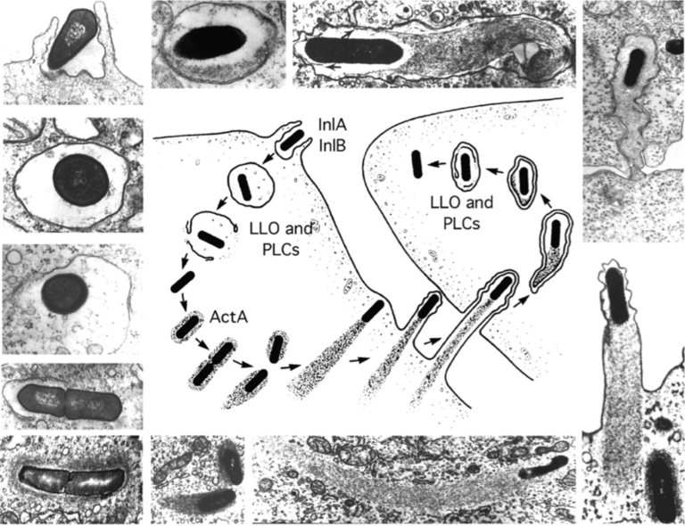Listeriosis Lysteria monocytogenes Bacteria & Food Poisoning