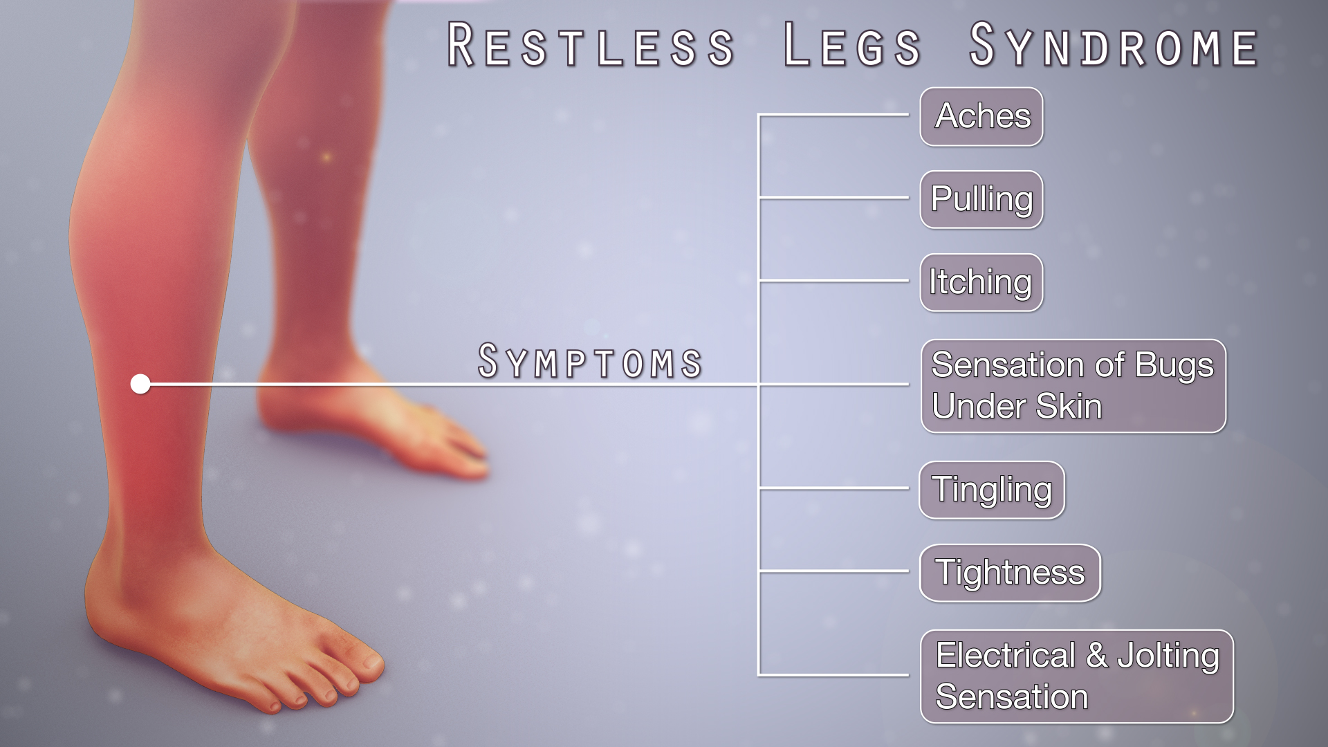 Restless Legs Syndrome Shown & Explained Using A Medical Animation